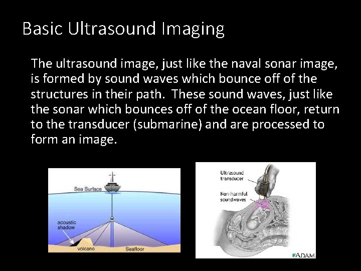 Basic Ultrasound Imaging The ultrasound image, just like the naval sonar image, is formed