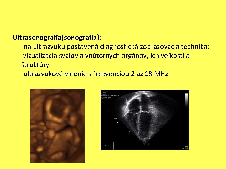 Ultrasonografia(sonografia): -na ultrazvuku postavená diagnostická zobrazovacia technika: vizualizácia svalov a vnútorných orgánov, ich veľkostí