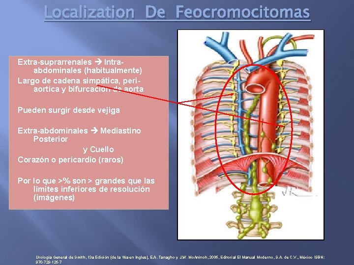 Localization De Feocromocitomas Extra-suprarrenales Intraabdominales (habitualmente) Largo de cadena simpática, periaortica y bifurcación de