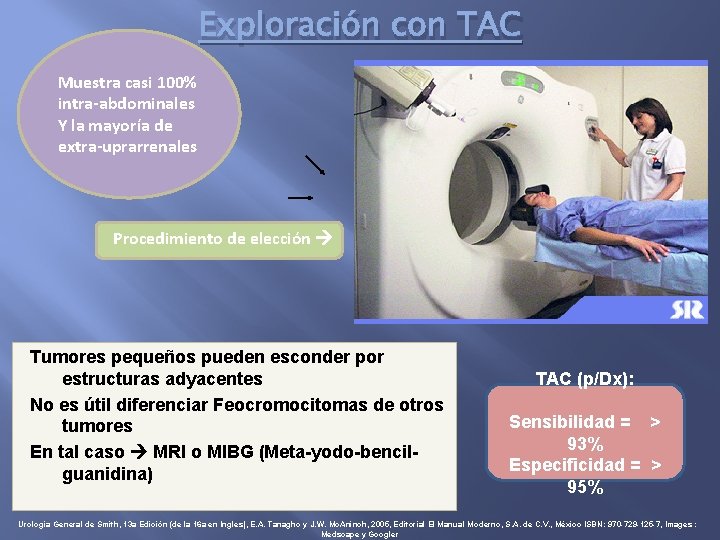 Exploración con TAC Muestra casi 100% intra-abdominales Y la mayoría de extra-uprarrenales Procedimiento de