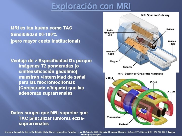 Exploración con MRI es tan bueno como TAC Sensibilidad 86 -100% (pero mayor costo
