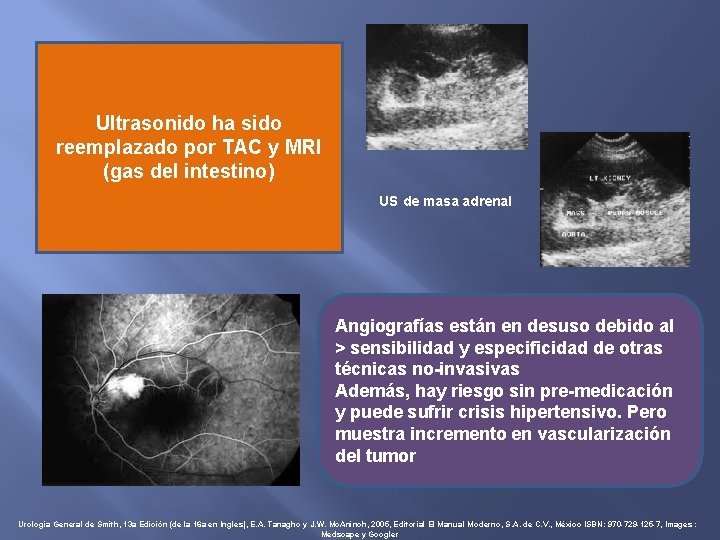 Ultrasonido ha sido reemplazado por TAC y MRI (gas del intestino) US de masa