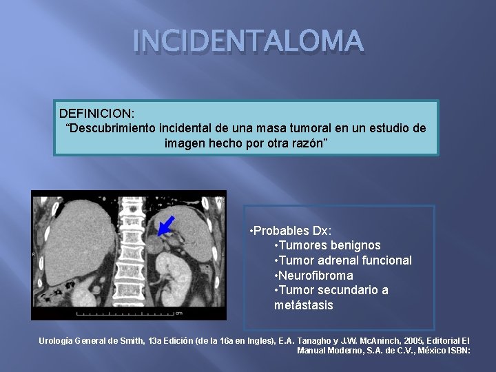 INCIDENTALOMA DEFINICION: “Descubrimiento incidental de una masa tumoral en un estudio de imagen hecho