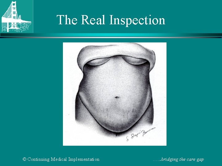 The Real Inspection © Continuing Medical Implementation …. . . bridging the care gap