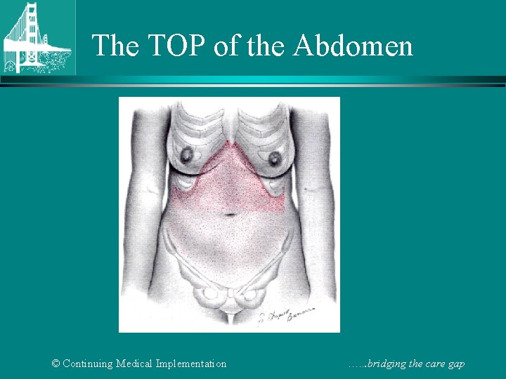 The TOP of the Abdomen © Continuing Medical Implementation …. . . bridging the