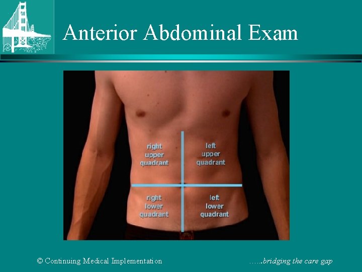 Anterior Abdominal Exam © Continuing Medical Implementation …. . . bridging the care gap
