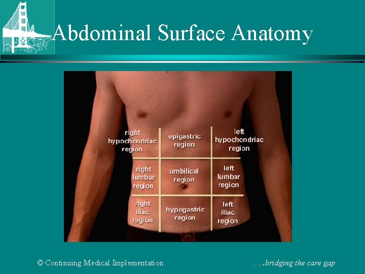 Abdominal Surface Anatomy © Continuing Medical Implementation …. . . bridging the care gap