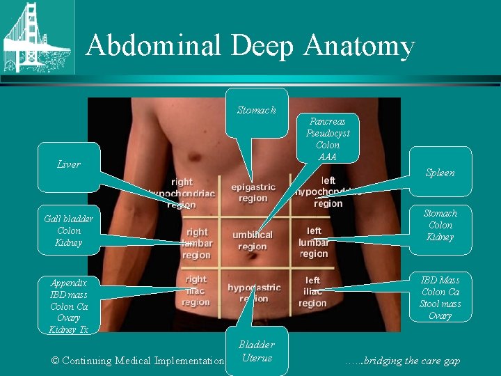 Abdominal Deep Anatomy Stomach Pancreas Pseudocyst Colon AAA Liver Spleen Stomach Colon Kidney Gall