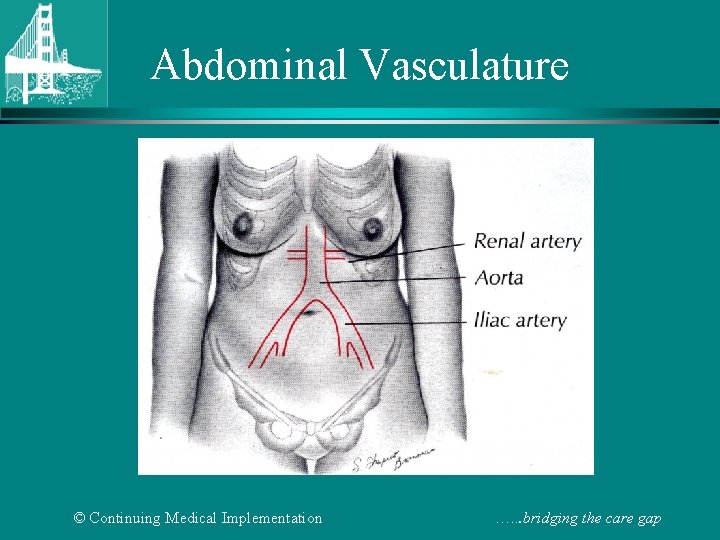 Abdominal Vasculature © Continuing Medical Implementation …. . . bridging the care gap 