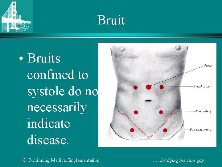 Bruit • Bruits confined to systole do not necessarily indicate disease. © Continuing Medical