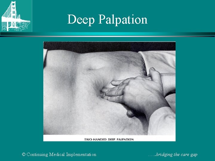Deep Palpation © Continuing Medical Implementation …. . . bridging the care gap 