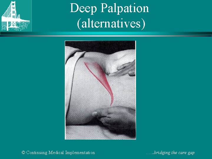 Deep Palpation (alternatives) © Continuing Medical Implementation …. . . bridging the care gap