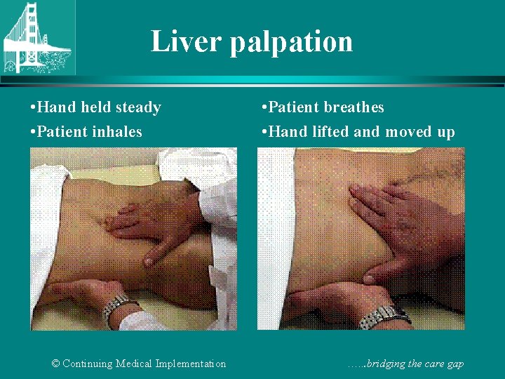 Liver palpation • Hand held steady • Patient inhales © Continuing Medical Implementation •