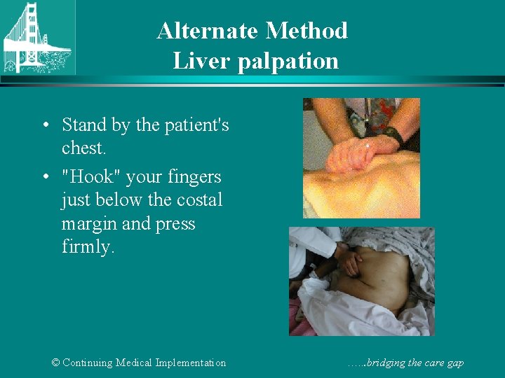 Alternate Method Liver palpation • Stand by the patient's chest. • "Hook" your fingers