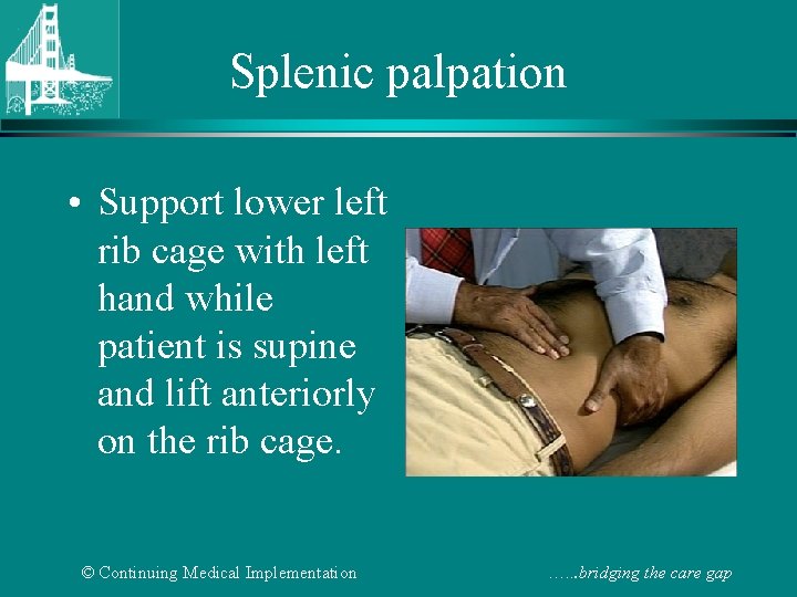 Splenic palpation • Support lower left rib cage with left hand while patient is