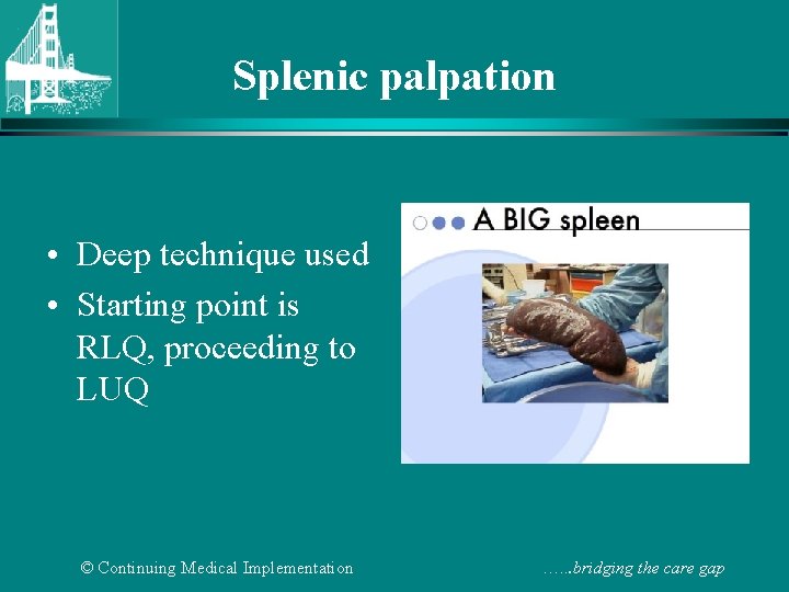 Splenic palpation • Deep technique used • Starting point is RLQ, proceeding to LUQ