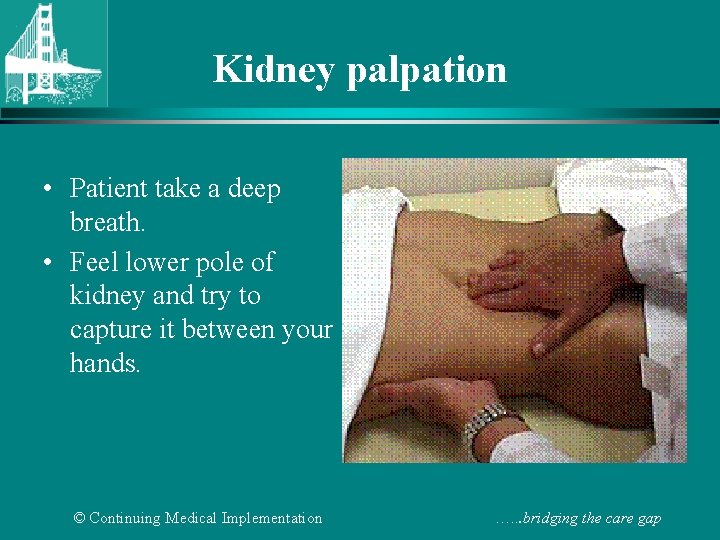 Kidney palpation • Patient take a deep breath. • Feel lower pole of kidney