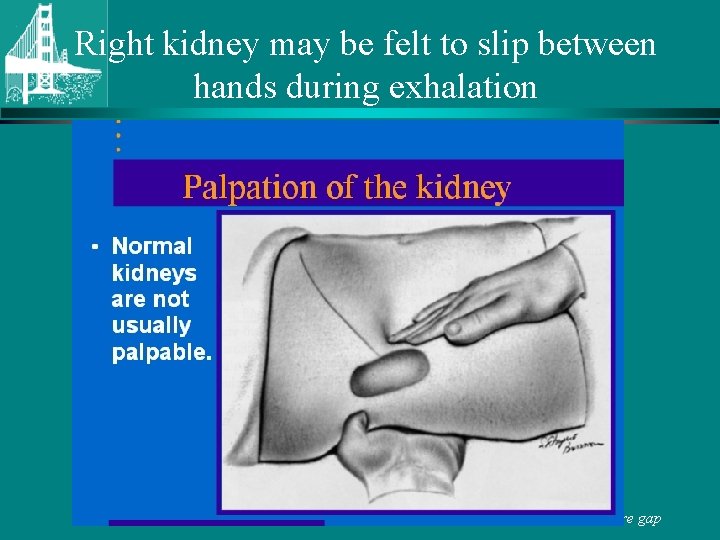 Right kidney may be felt to slip between hands during exhalation © Continuing Medical