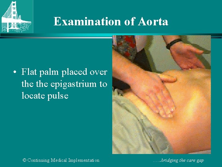 Examination of Aorta • Flat palm placed over the epigastrium to locate pulse ©