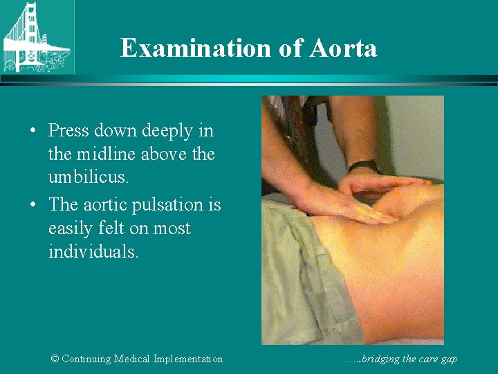 Examination of Aorta • Press down deeply in the midline above the umbilicus. •