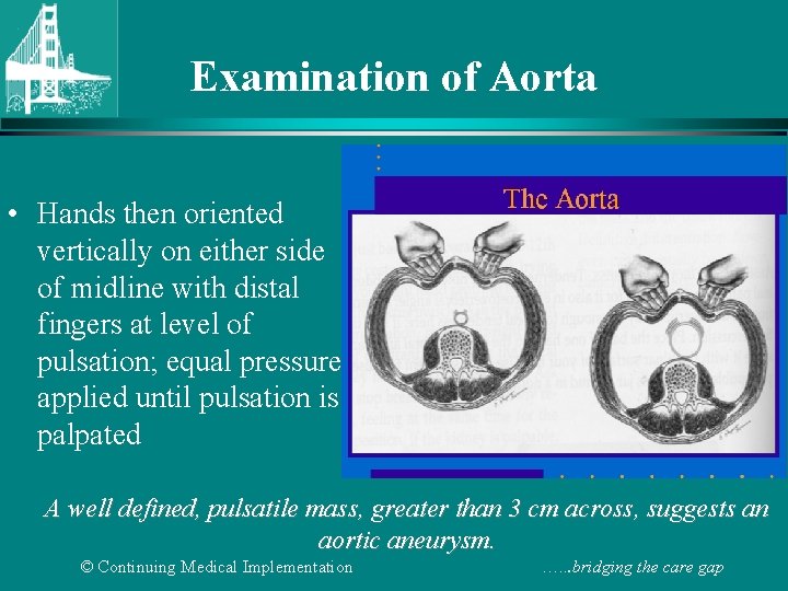 Examination of Aorta • Hands then oriented vertically on either side of midline with
