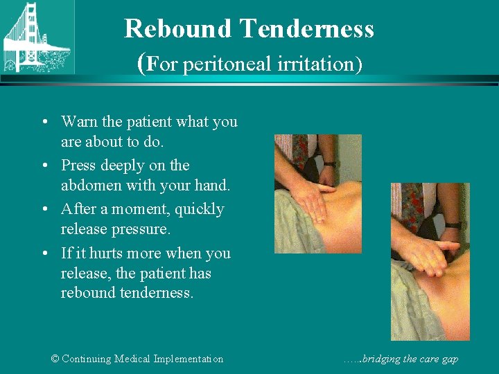 Rebound Tenderness (For peritoneal irritation) • Warn the patient what you are about to