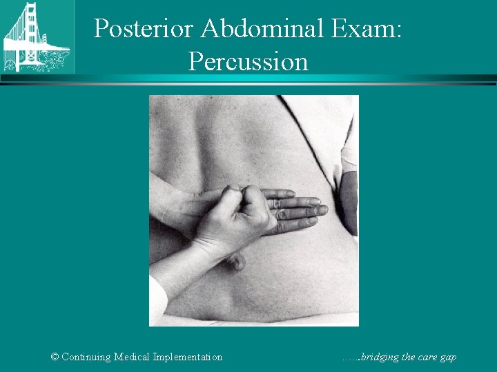 Posterior Abdominal Exam: Percussion © Continuing Medical Implementation …. . . bridging the care