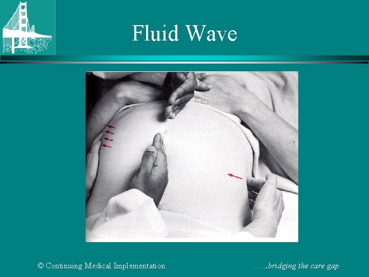 Fluid Wave © Continuing Medical Implementation …. . . bridging the care gap 