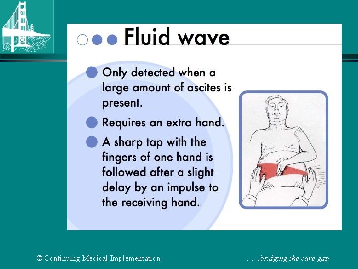 © Continuing Medical Implementation …. . . bridging the care gap 
