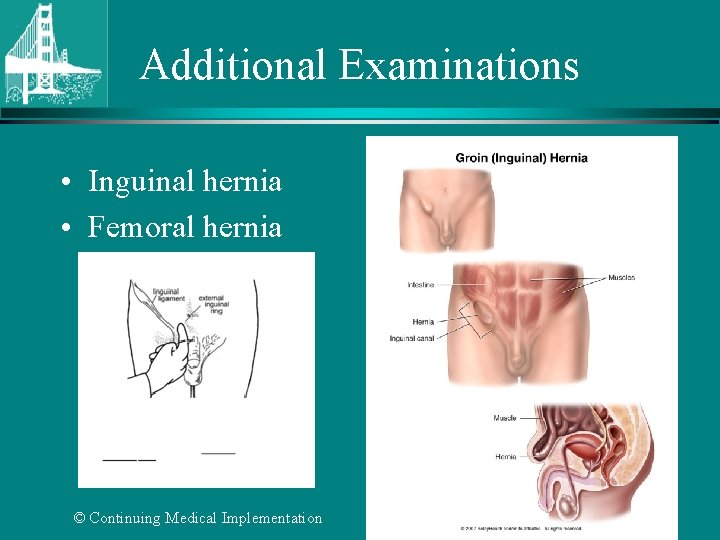 Additional Examinations • Inguinal hernia • Femoral hernia © Continuing Medical Implementation …. .