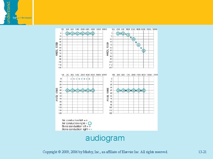 audiogram Copyright © 2009, 2006 by Mosby, Inc. , an affiliate of Elsevier Inc.