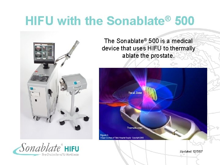 HIFU with the Sonablate® 500 The Sonablate® 500 is a medical device that uses