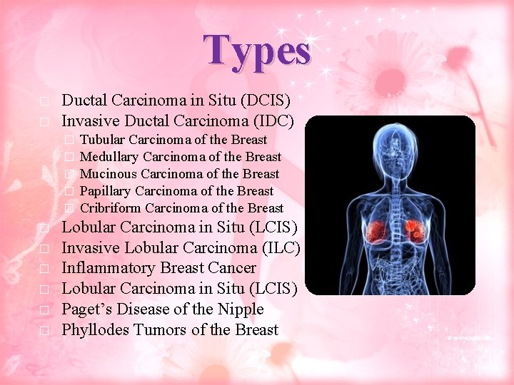 Types � � Ductal Carcinoma in Situ (DCIS) Invasive Ductal Carcinoma (IDC) � �
