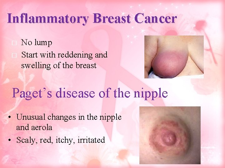 Inflammatory Breast Cancer � � No lump Start with reddening and swelling of the