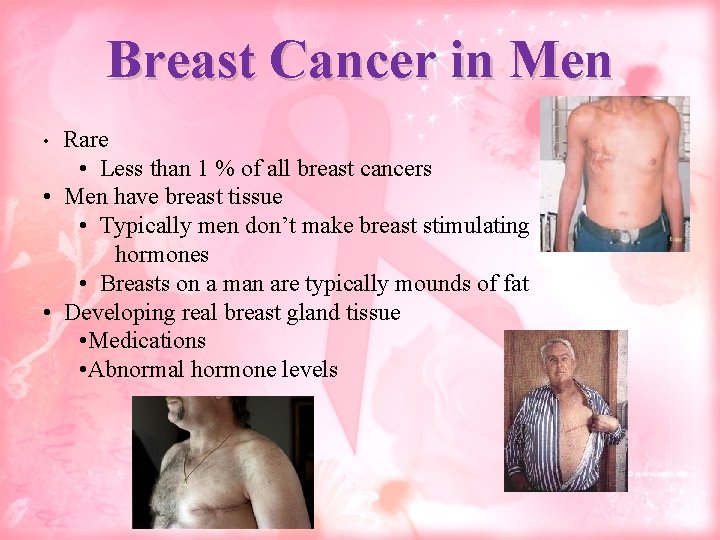 Breast Cancer in Men Rare • Less than 1 % of all breast cancers