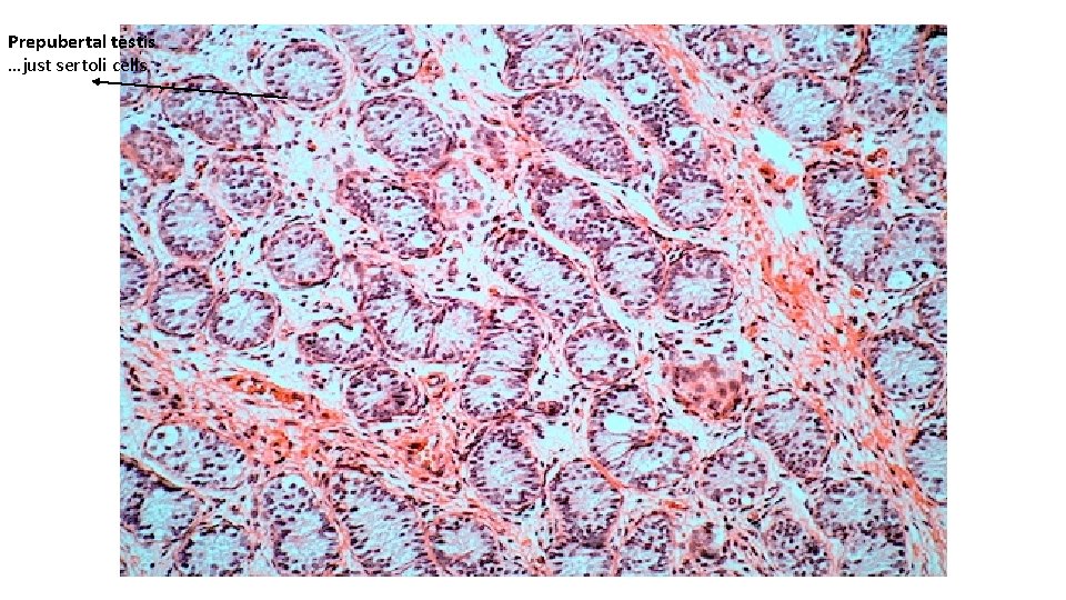 Prepubertal testis …just sertoli cells 