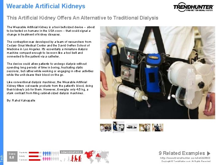 Tech Wearable Artificial Kidneys This Artificial Kidney Offers An Alternative to Traditional Dialysis The