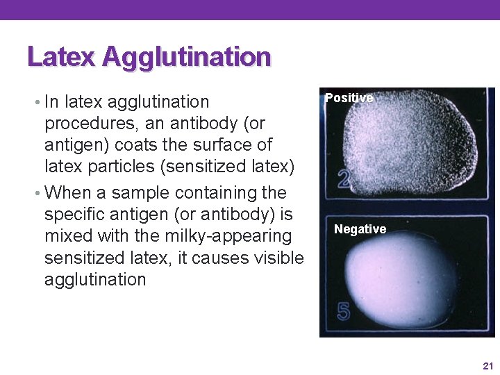 Latex Agglutination • In latex agglutination procedures, an antibody (or antigen) coats the surface Latex Agglutination • In latex agglutination procedures, an antibody (or antigen) coats the surface
