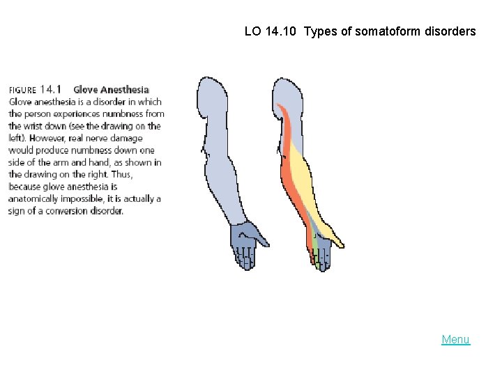 LO 14. 10 Types of somatoform disorders Menu 