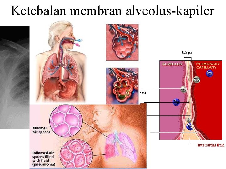 Ketebalan membran alveolus-kapiler 