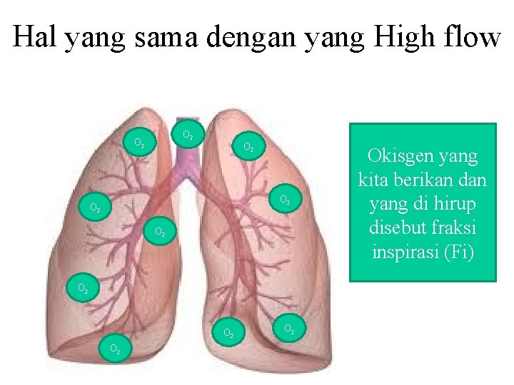 Hal yang sama dengan yang High flow O 2 O 2 O 2 Okisgen