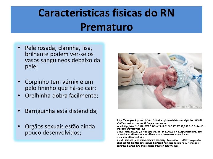 Caracteristicas fisicas do RN Prematuro https: //www. google. pt/search? hl=en&site=imghp&tbm=isch&source=hp&biw=1192&bih =543&q=vernix+recem-nascido&oq=vernix+recemnascido&gs_l=img. 3. . .