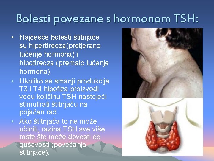Bolesti povezane s hormonom TSH: • Najčešće bolesti štitnjače su hipertireoza(pretjerano lučenje hormona) i
