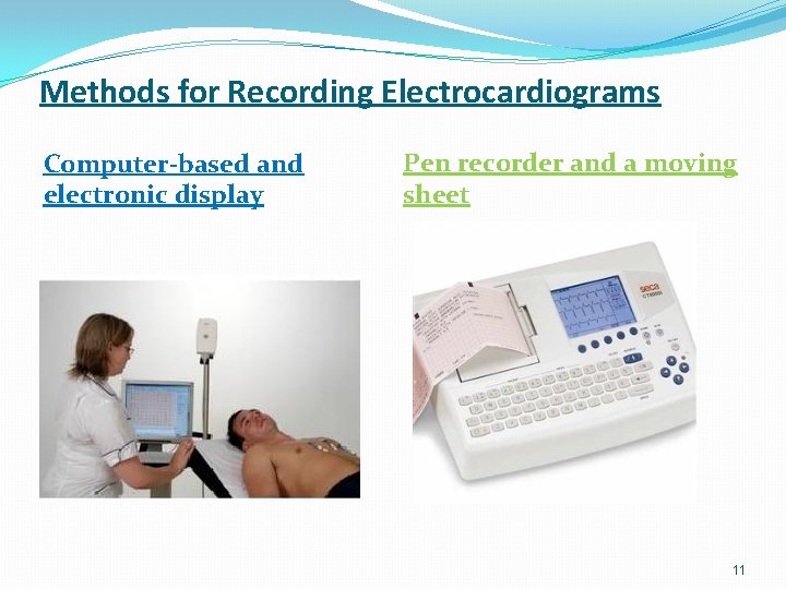 Methods for Recording Electrocardiograms Computer-based and electronic display Pen recorder and a moving sheet