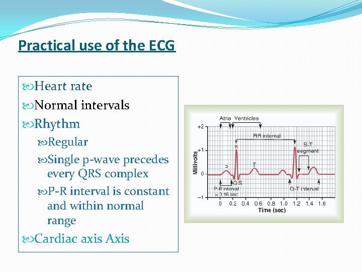 Practical use of the ECG Heart rate Normal intervals Rhythm Regular Single p-wave precedes