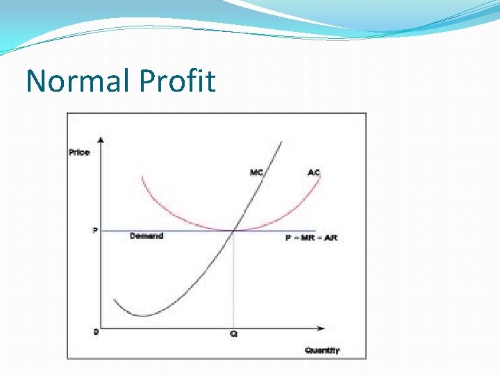 Normal Profit 
