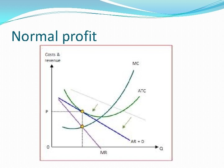 Normal profit 