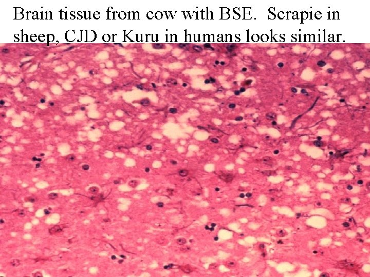 Brain tissue from cow with BSE. Scrapie in sheep, CJD or Kuru in humans