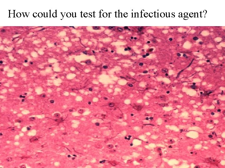 How could you test for the infectious agent? 