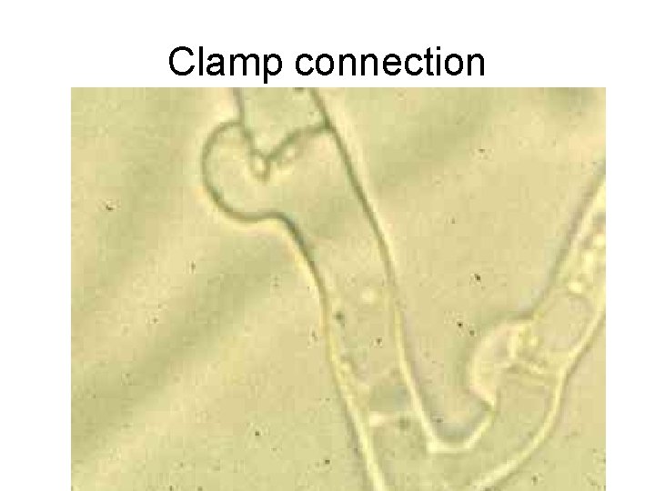 Clamp connection 